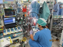 人工心肺装置の操作